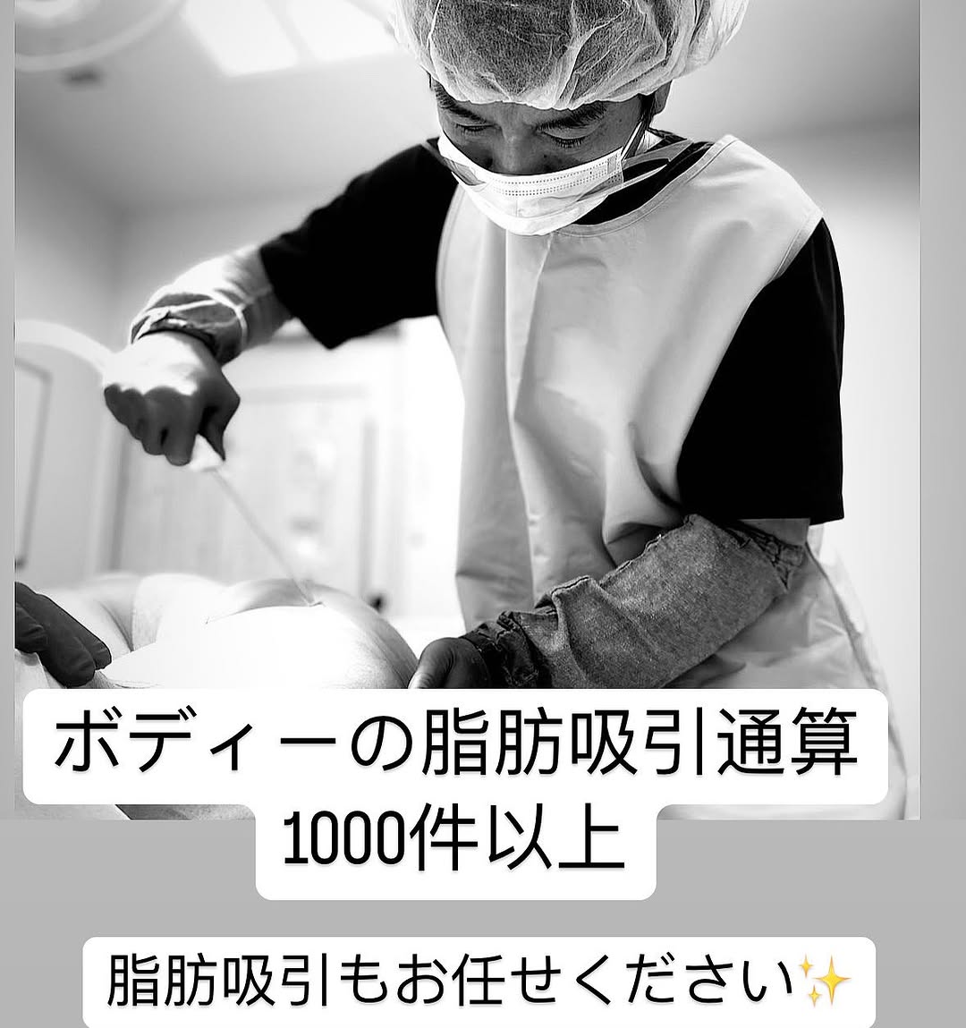 脂肪吸引