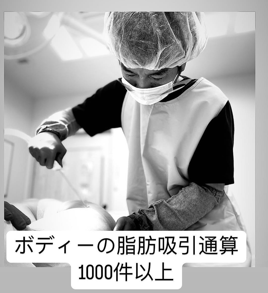 脂肪吸引