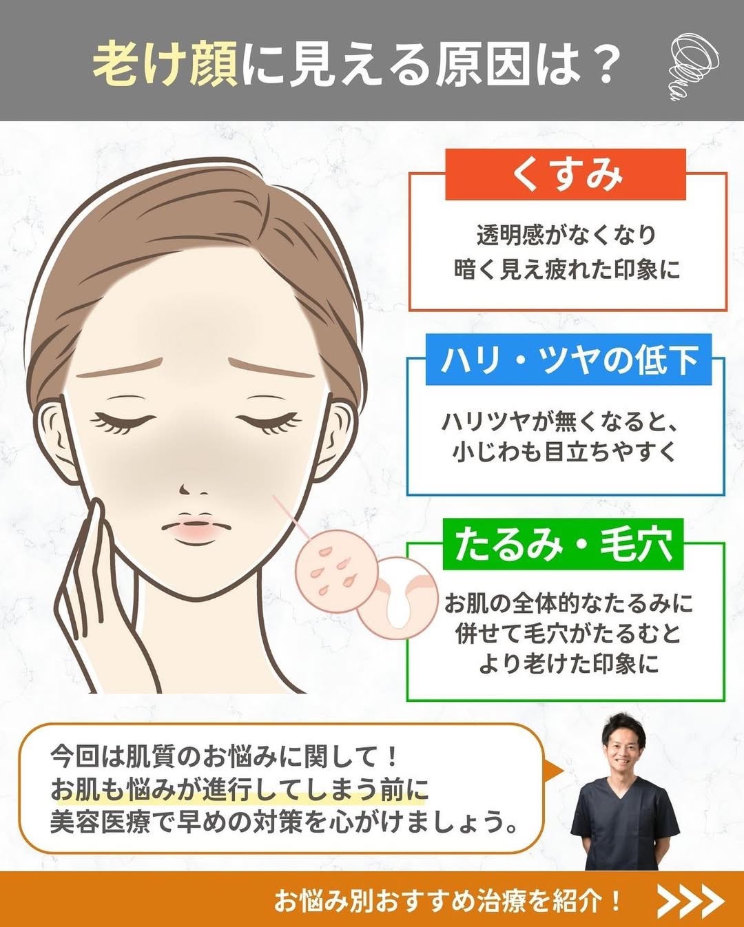 老け顔