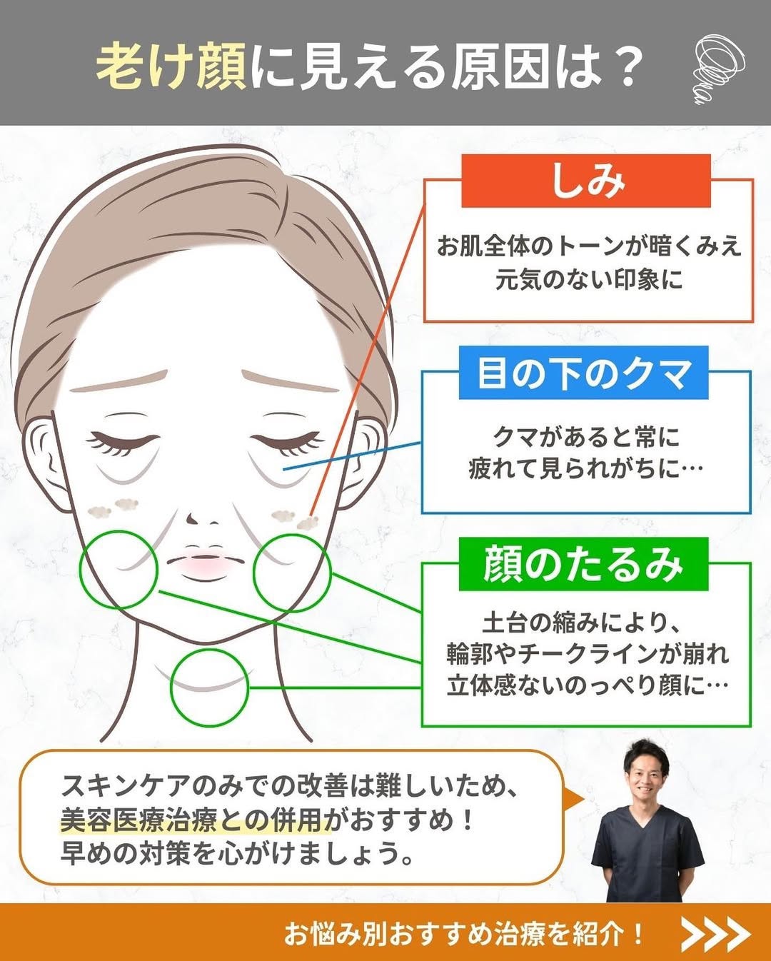 老け顔