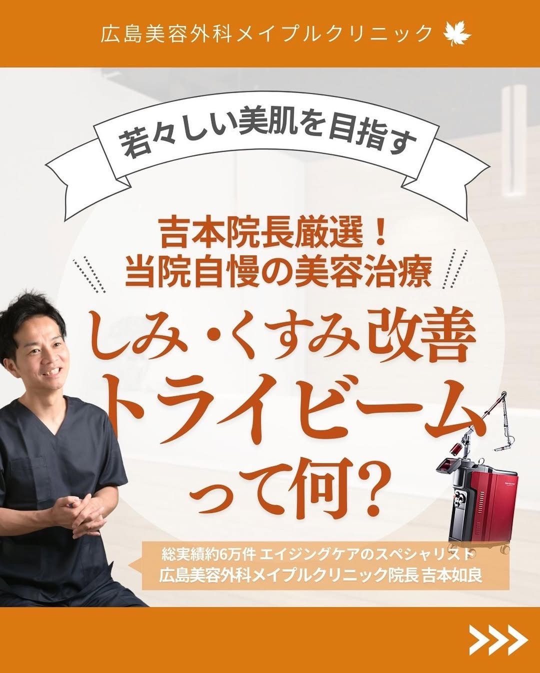 トライビーム