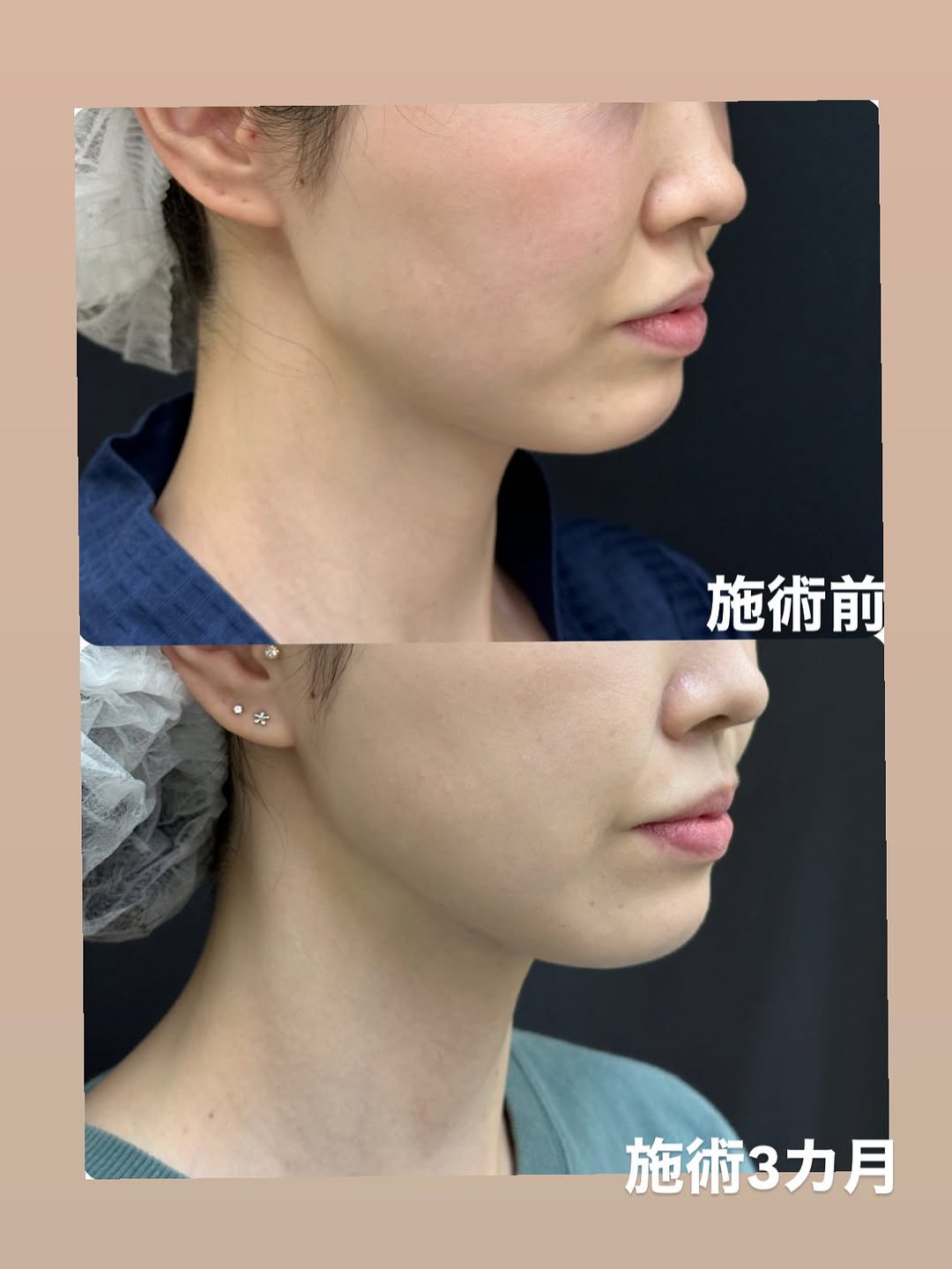 施術症例