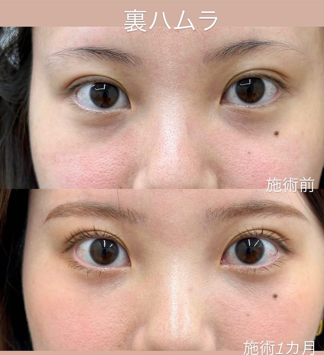 クマ治療のメイン画像