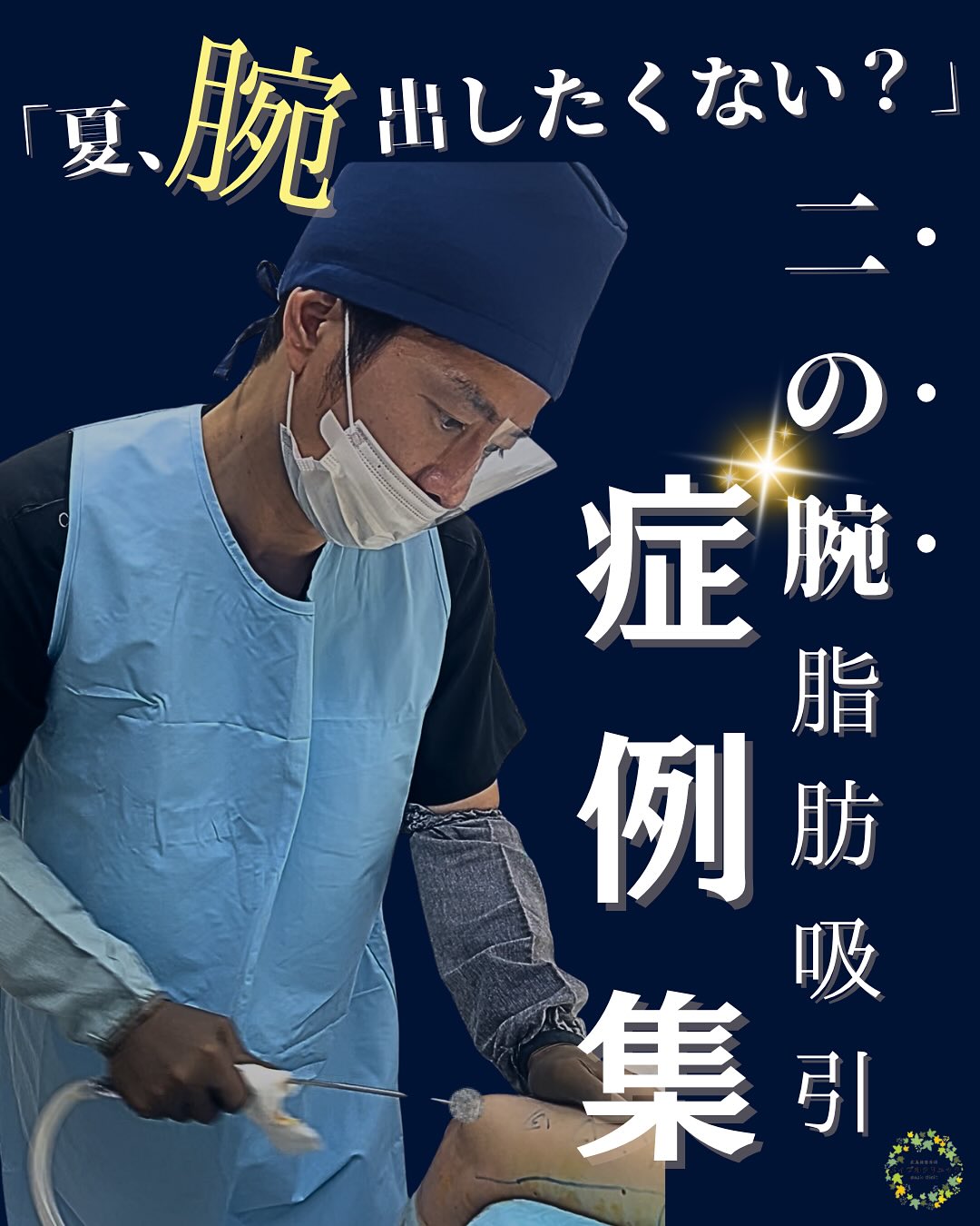二の腕脂肪吸引のメイン画像