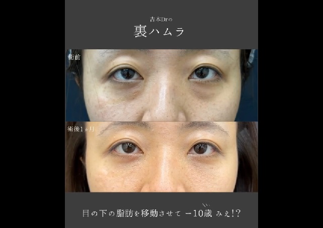 若返り治療のメイン画像