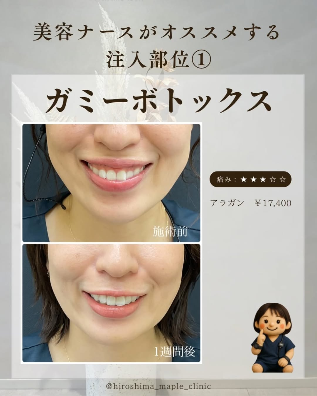 ガミーボトックス