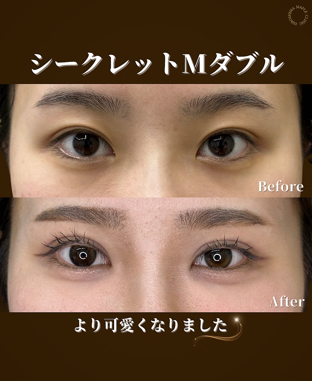 埋没法　-シークレットMダブル-のメイン画像