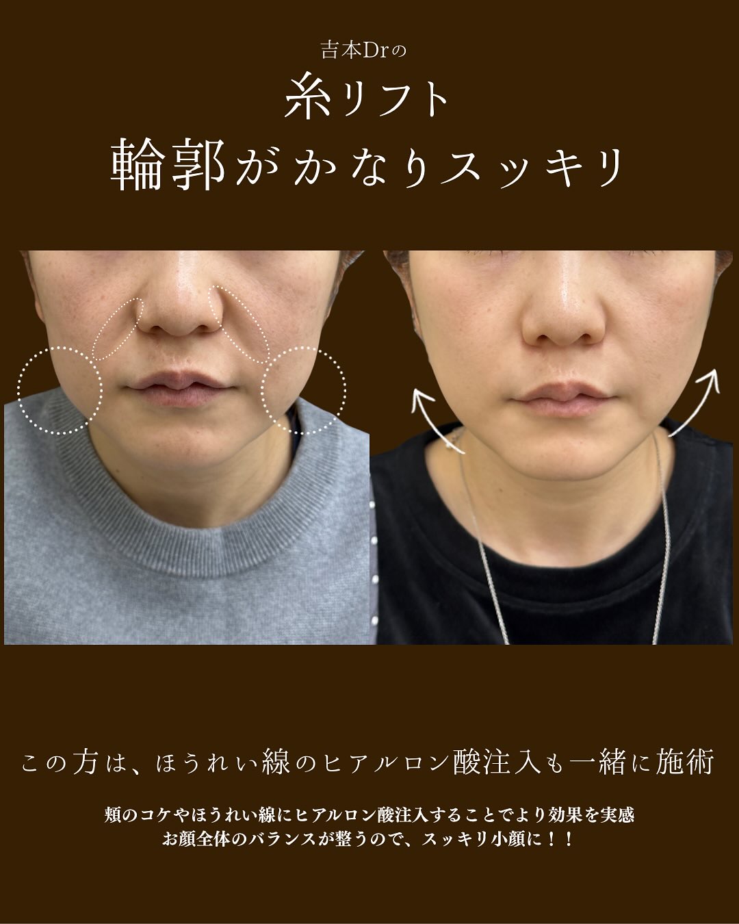 施術後