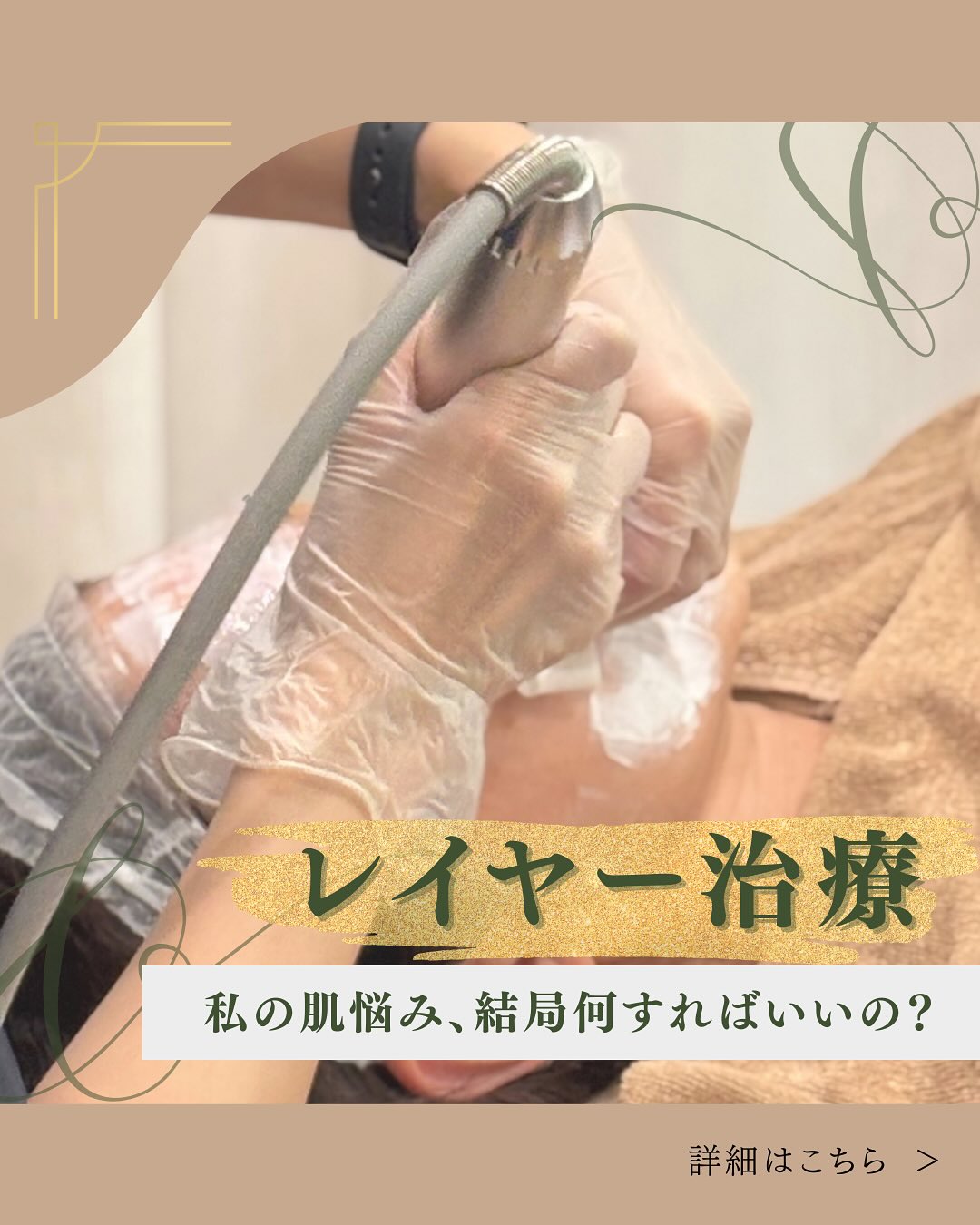 レイヤー治療についてのメイン画像