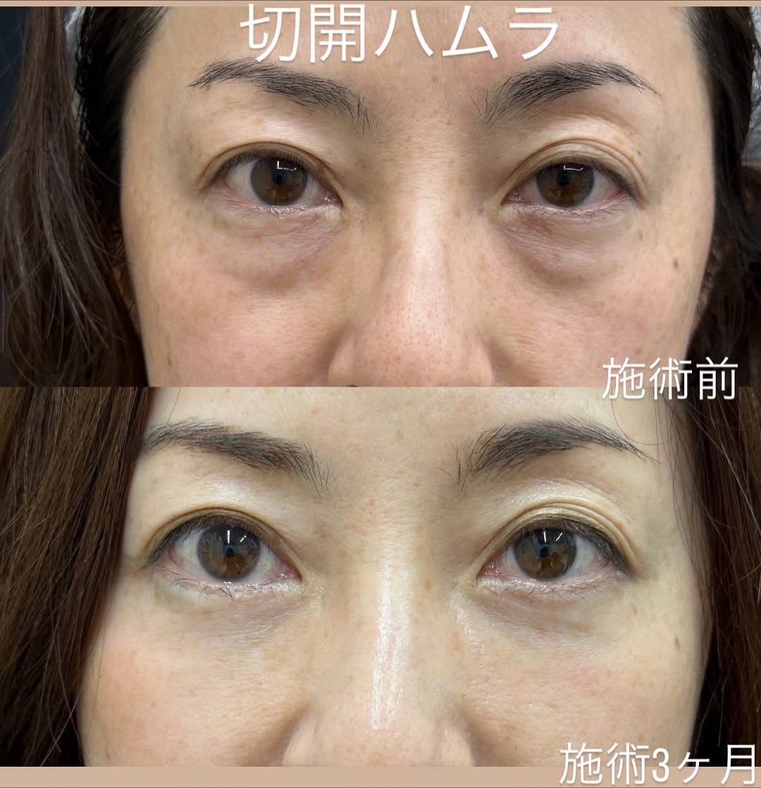 切開ハムラのメイン画像