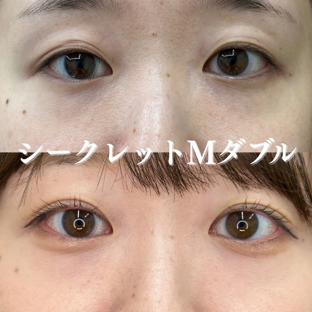 埋没法シークレットMダブルのメイン画像