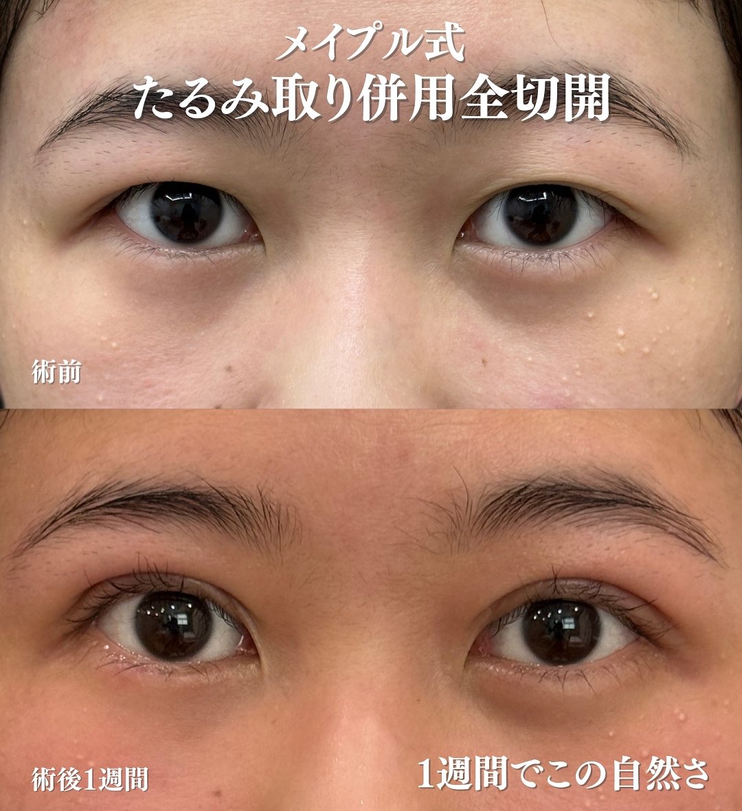 術後経過