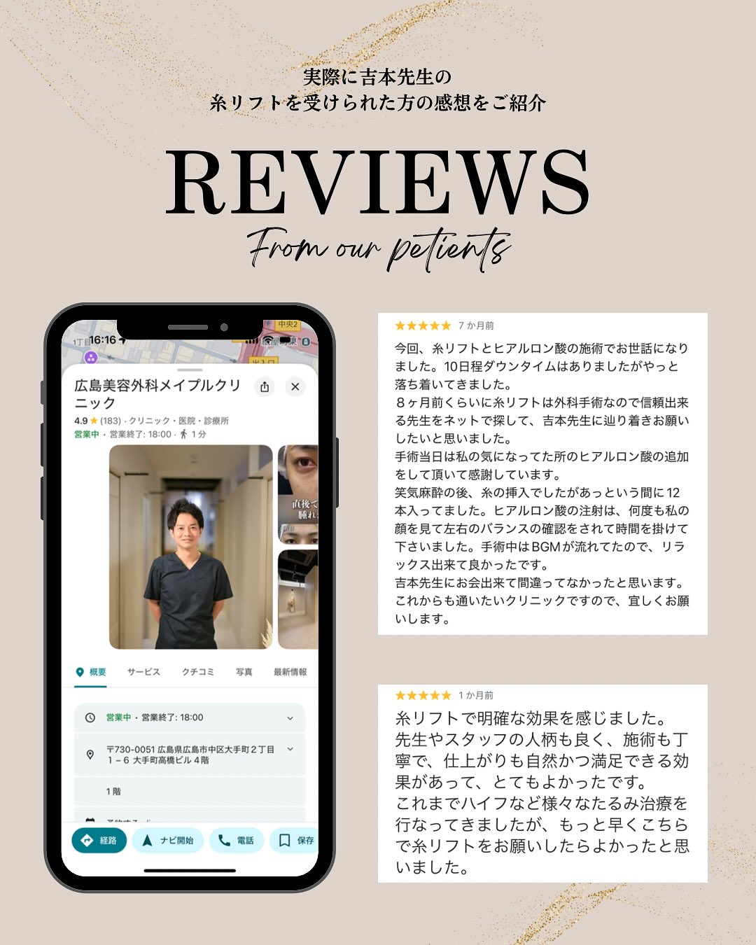 糸リフトの評判