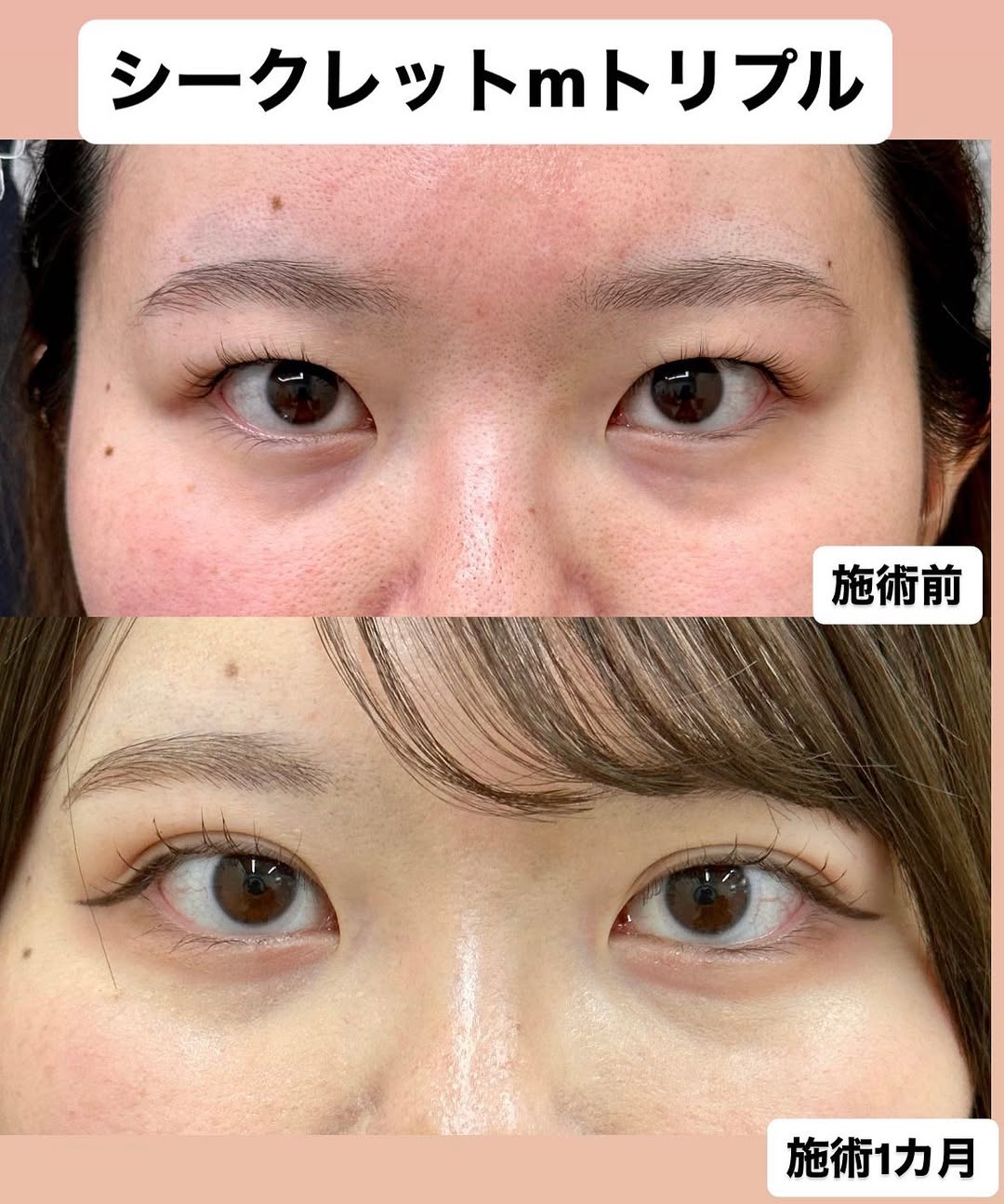 埋没法-シークレットMトリプル-のメイン画像