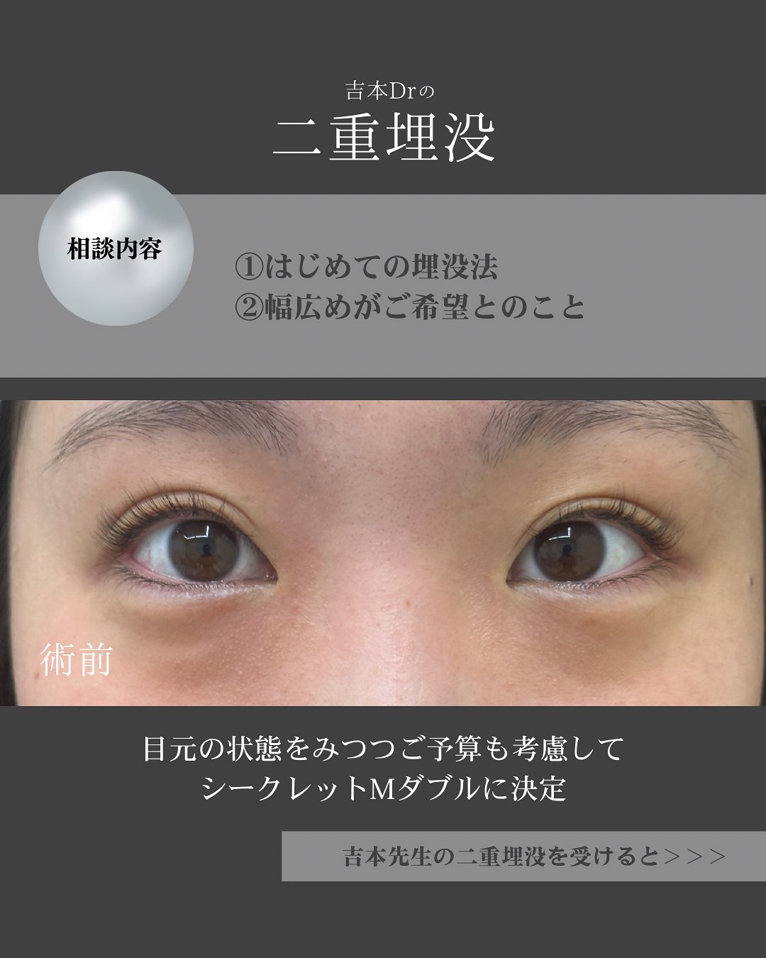 シークレットMダブル