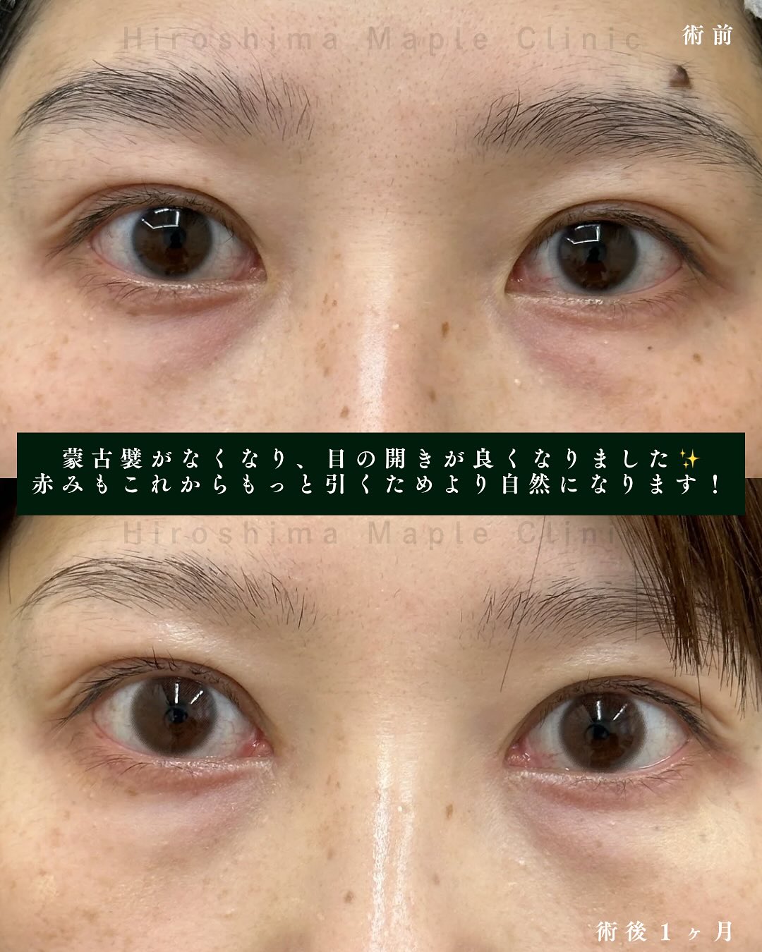 症例