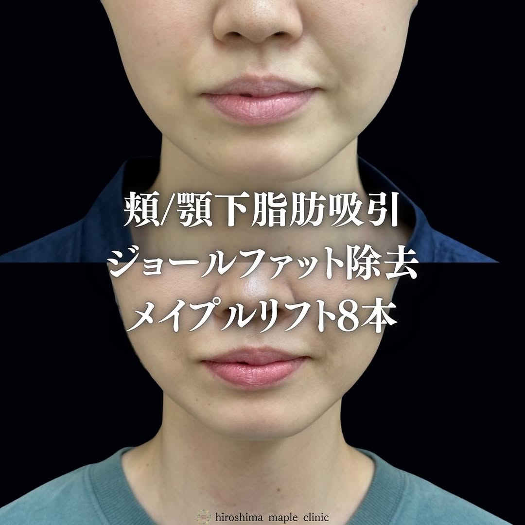 顔の施術