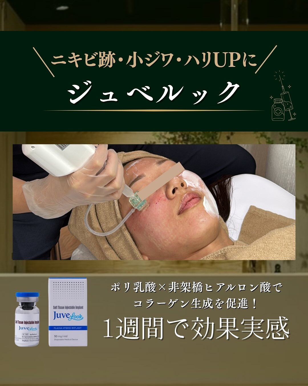 ジュベルック