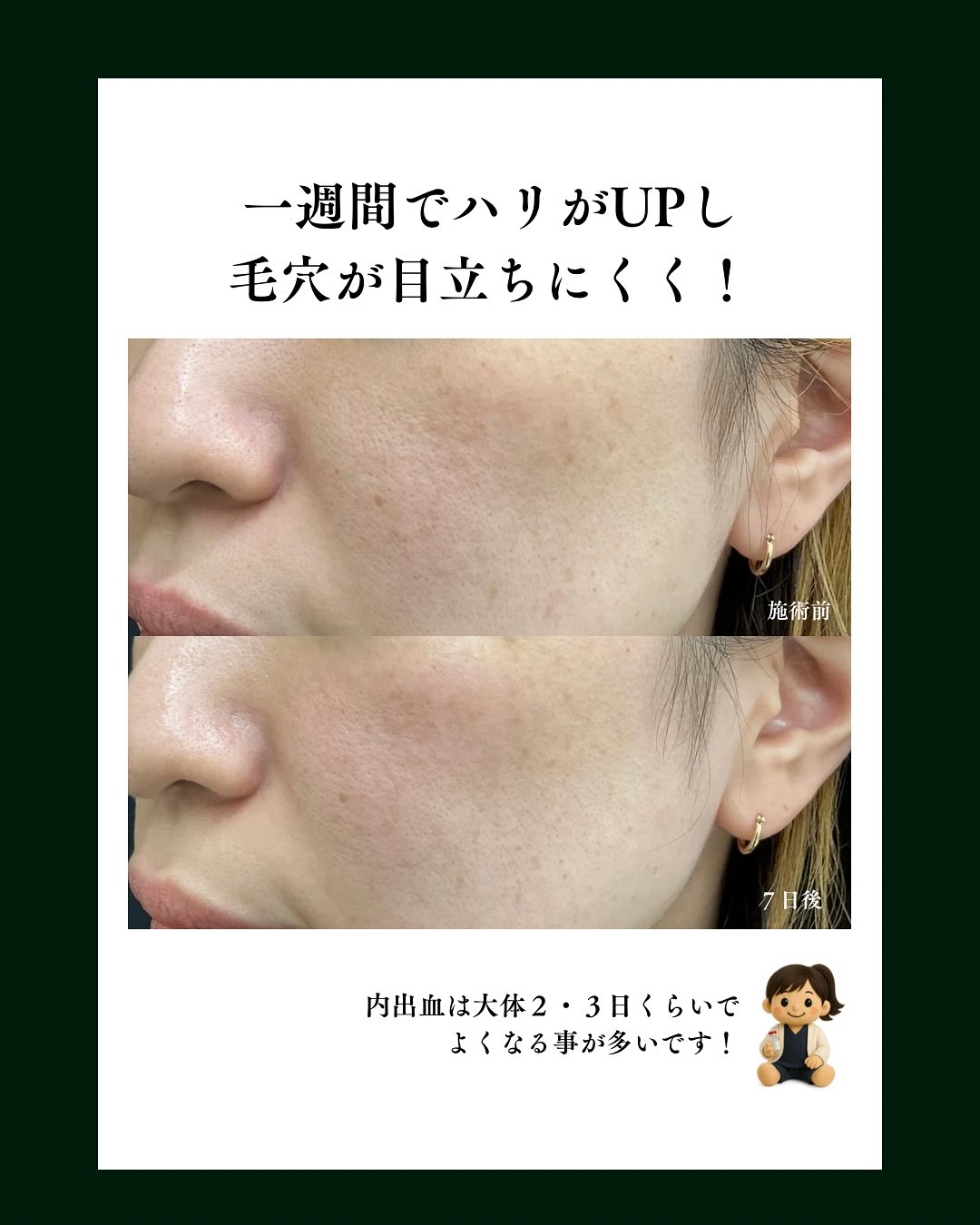 効果