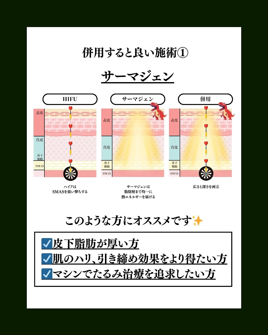 サーマジェン