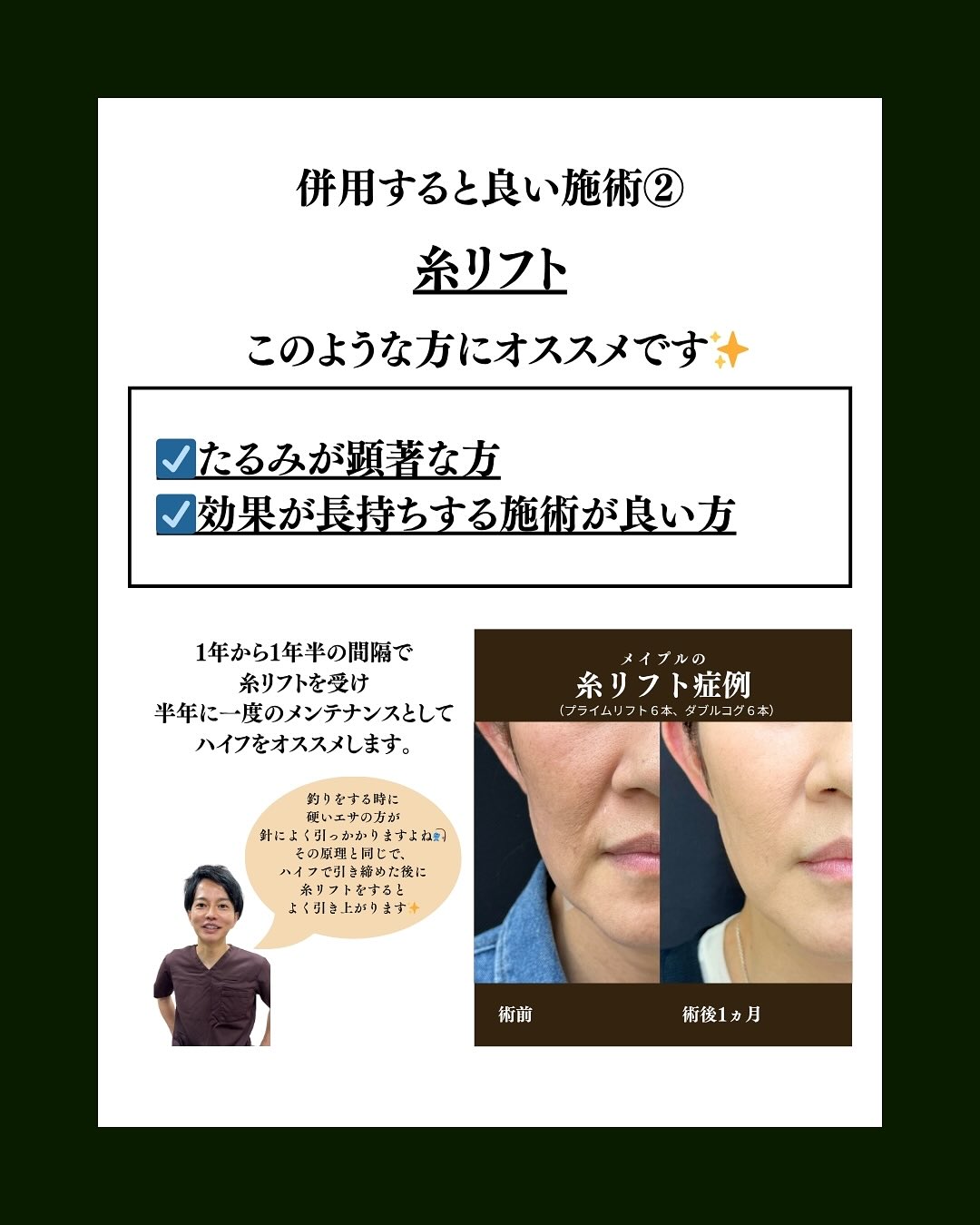 糸リフト併用
