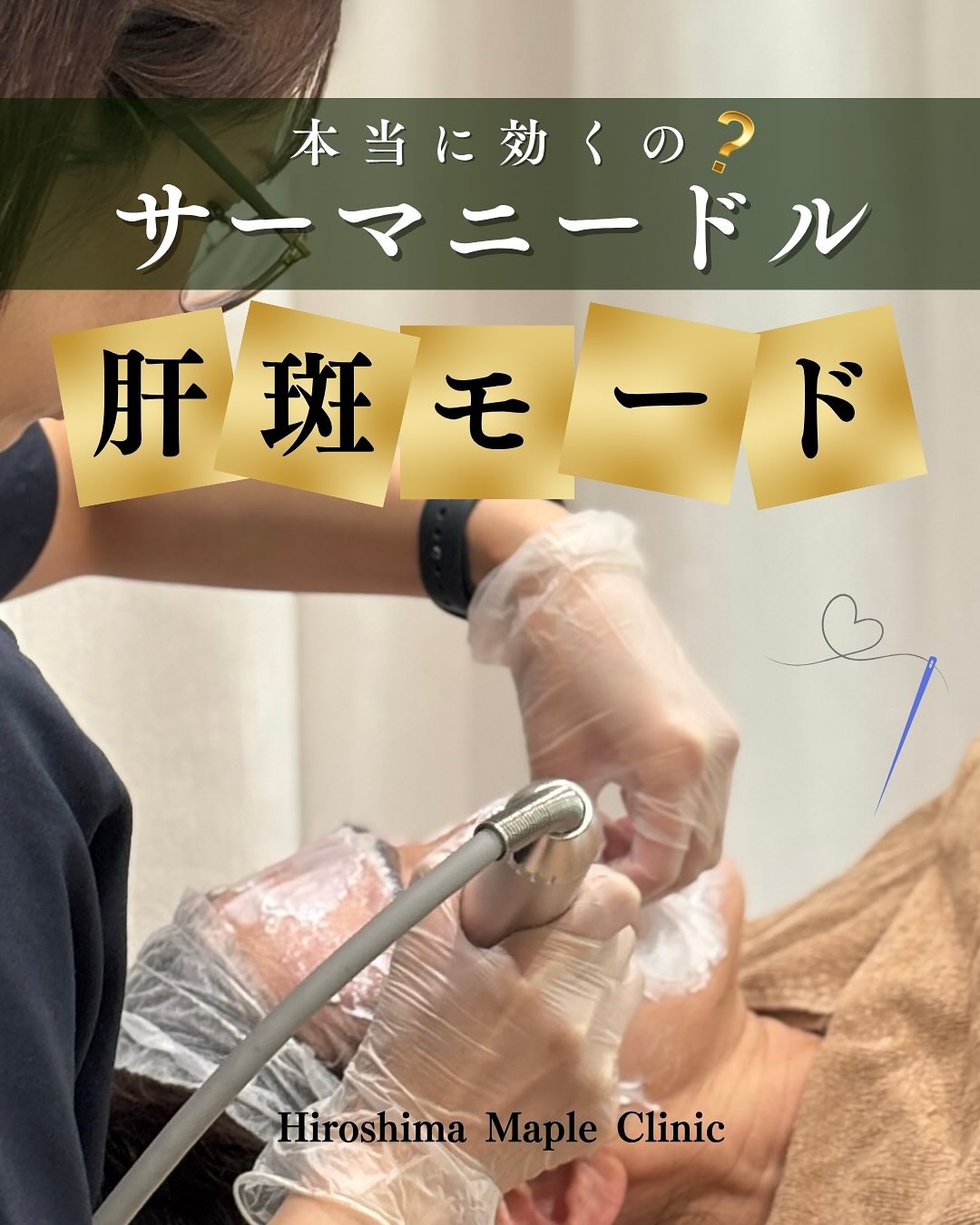 サーマニードル