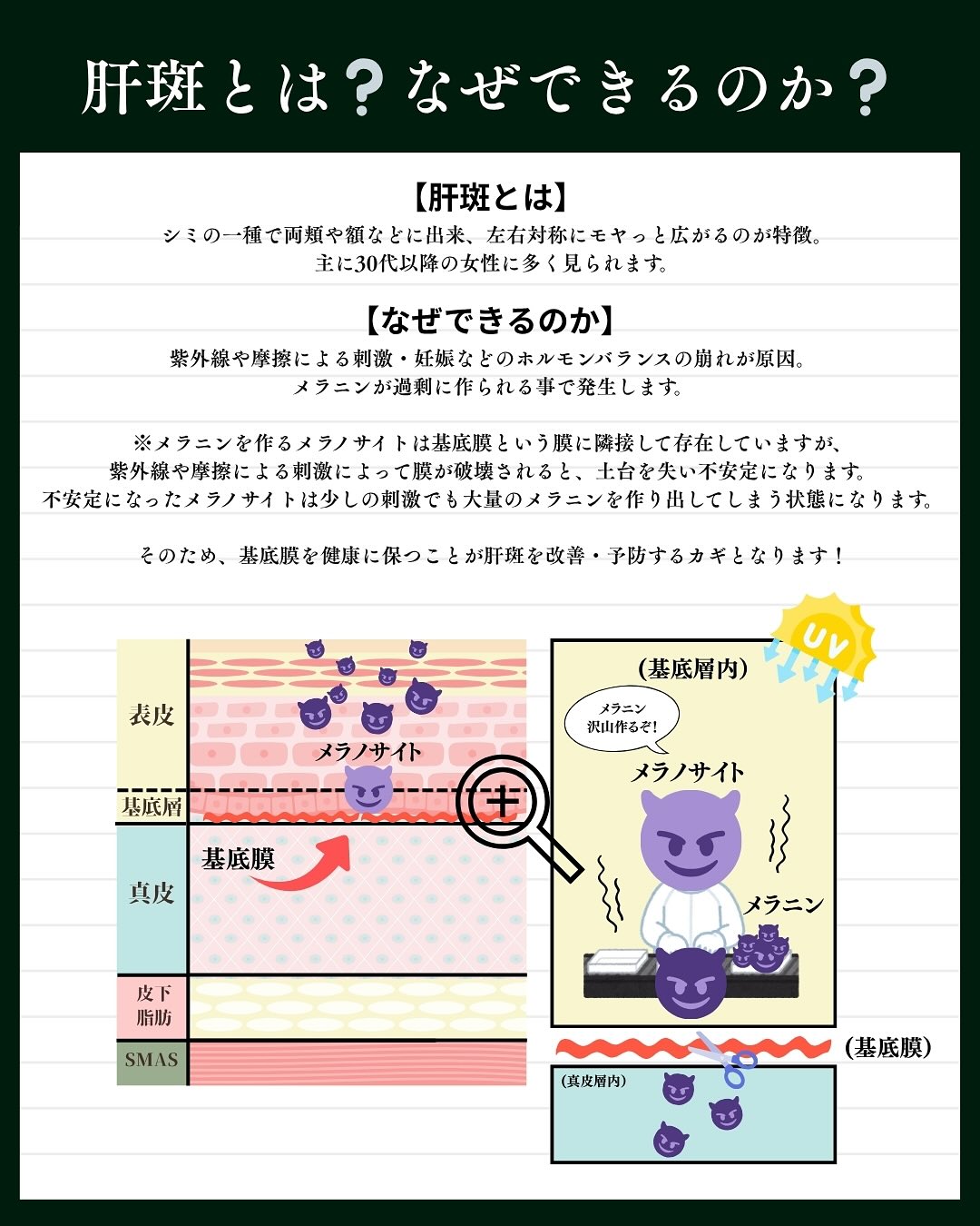 肝斑とは