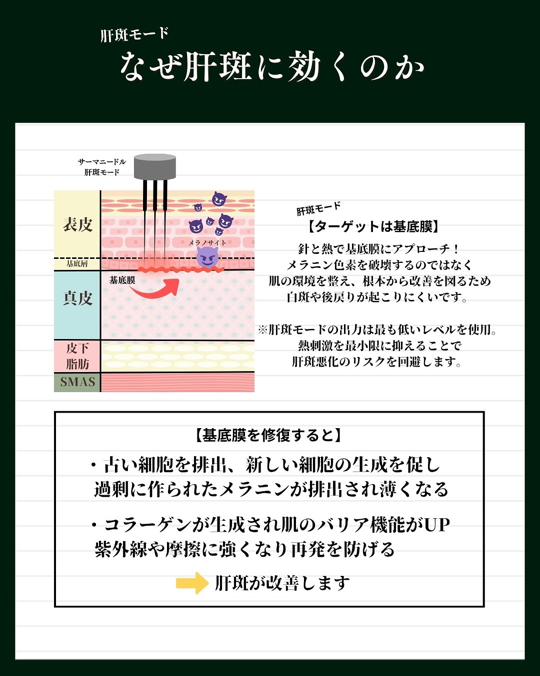 かぜ肝斑に効くか