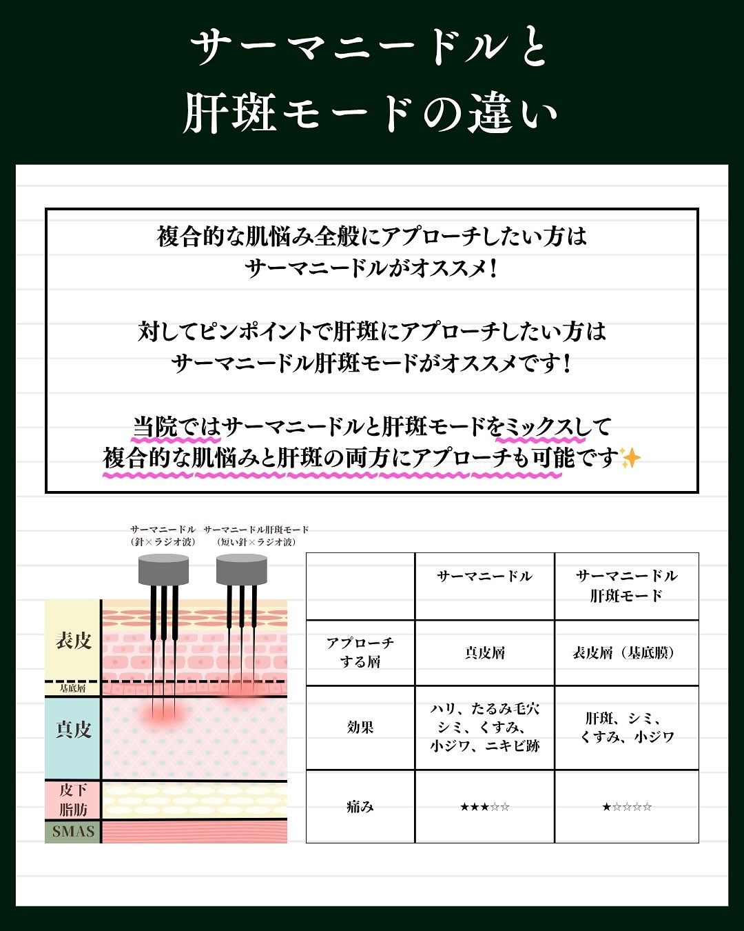 違い