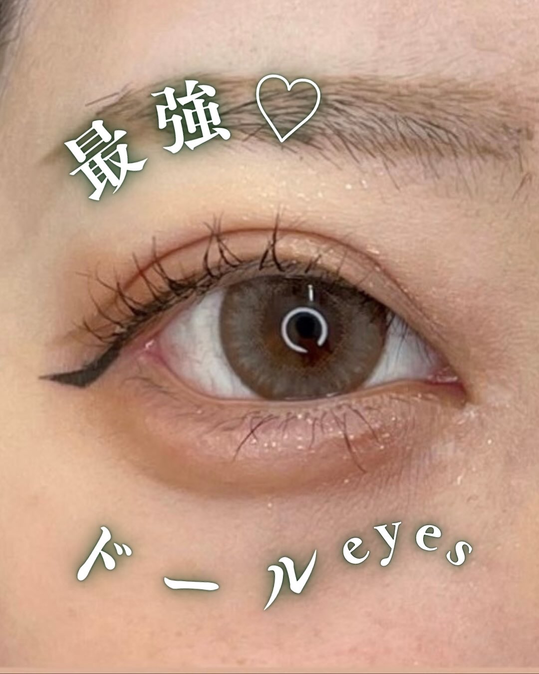 全切開＋下眼瞼下制＋目尻切開のメイン画像