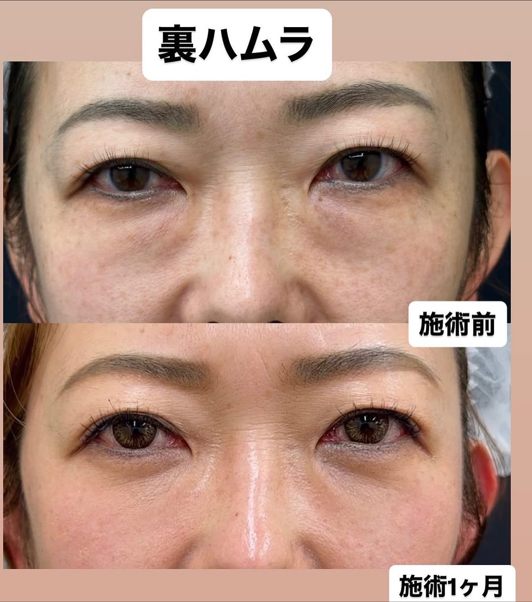 広島近郊でクマでお悩みの方へのメイン画像