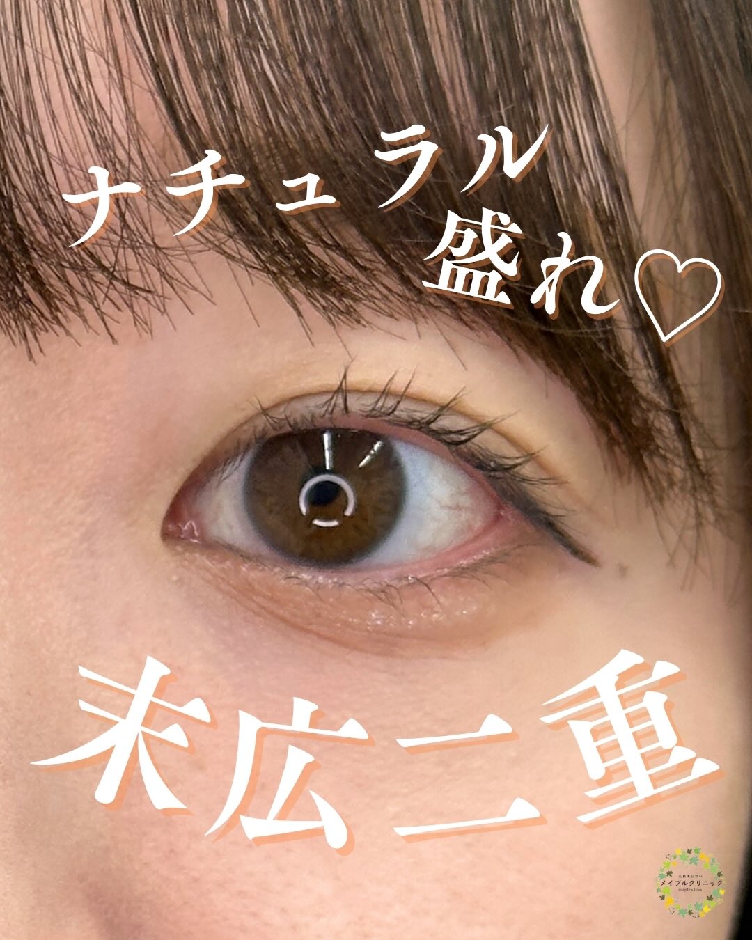 ナチュラル盛れの末広二重のメイン画像