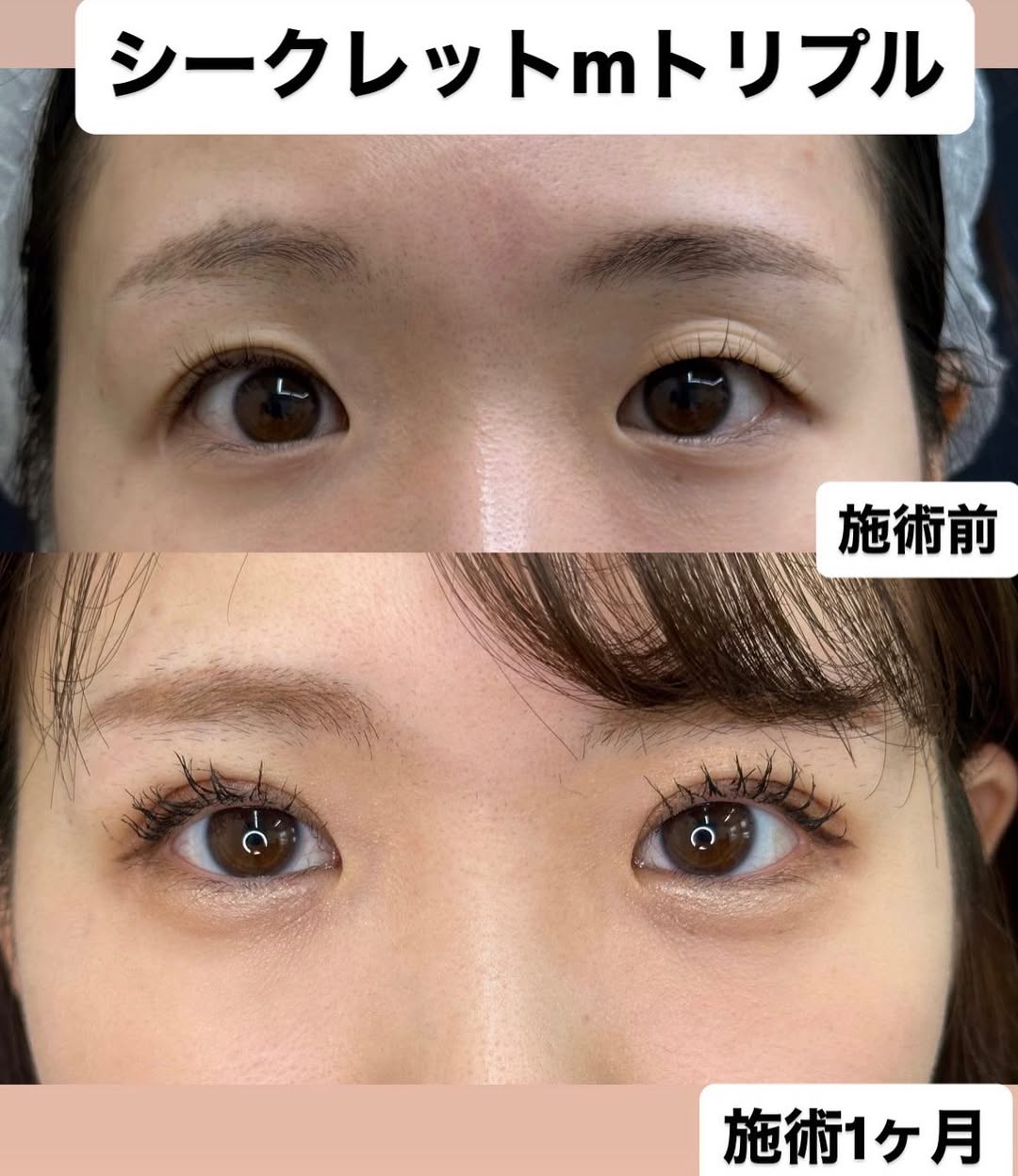 埋没法で華やかな目元にのメイン画像