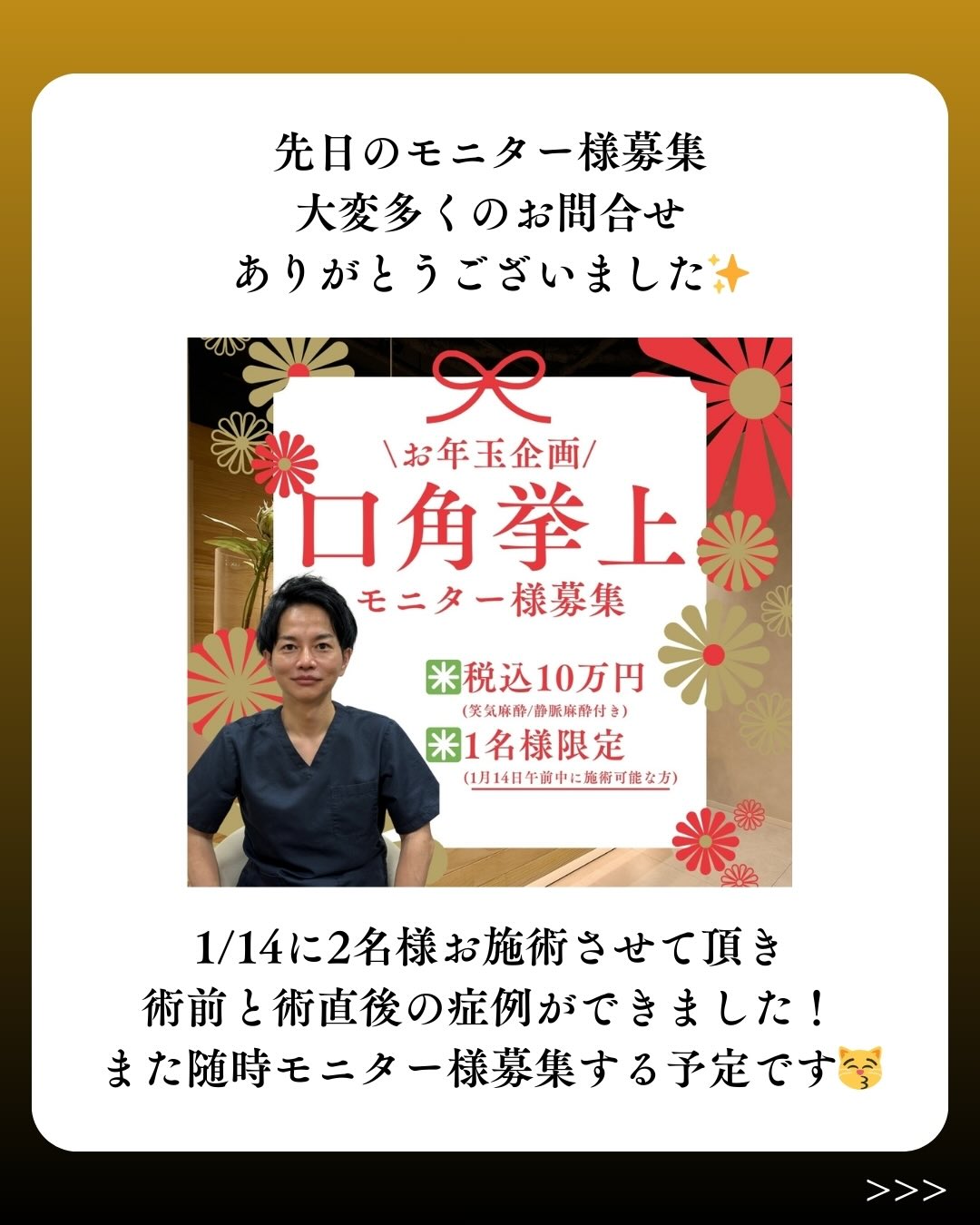 口角拳上モニター