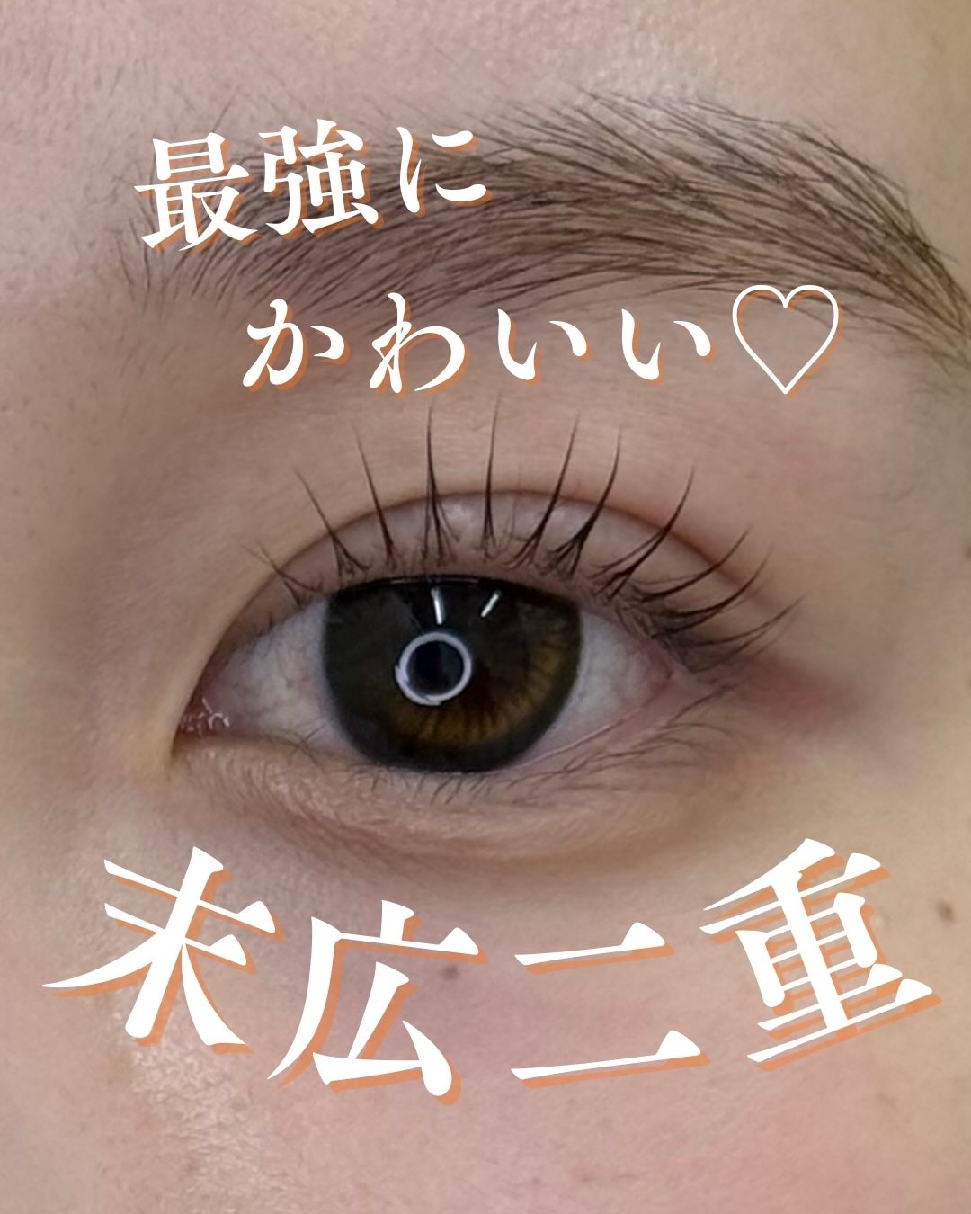 埋没法で末広二重にのメイン画像