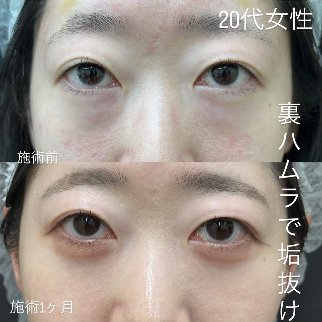 裏ハムラは自然に垢抜ける！のメイン画像