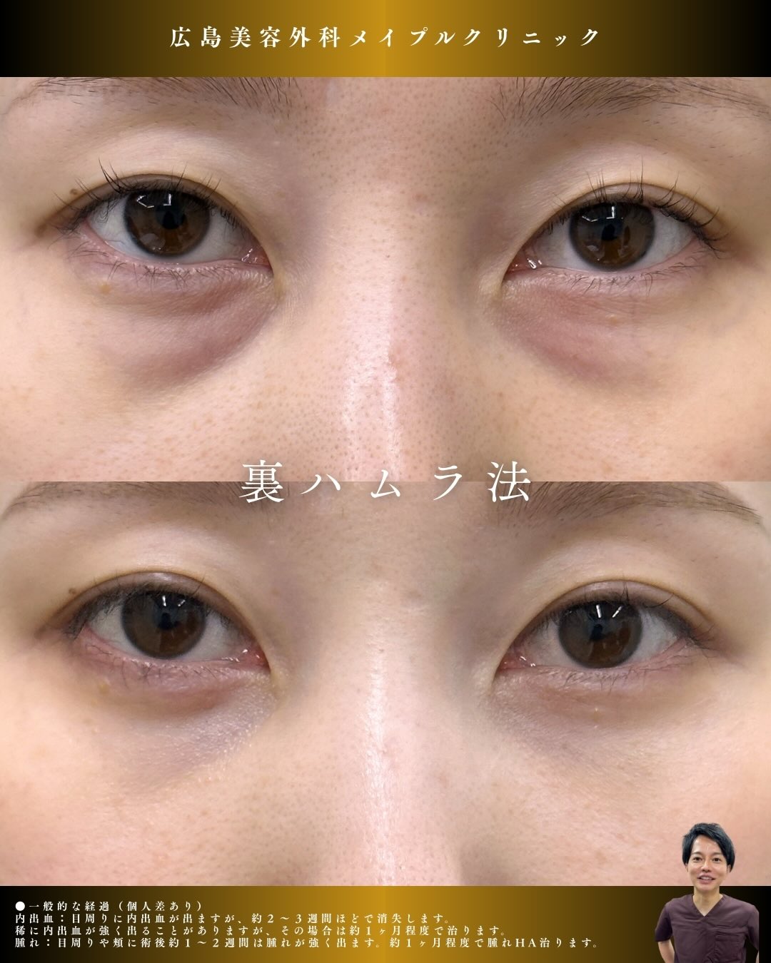 目の下のたるみを改善のメイン画像