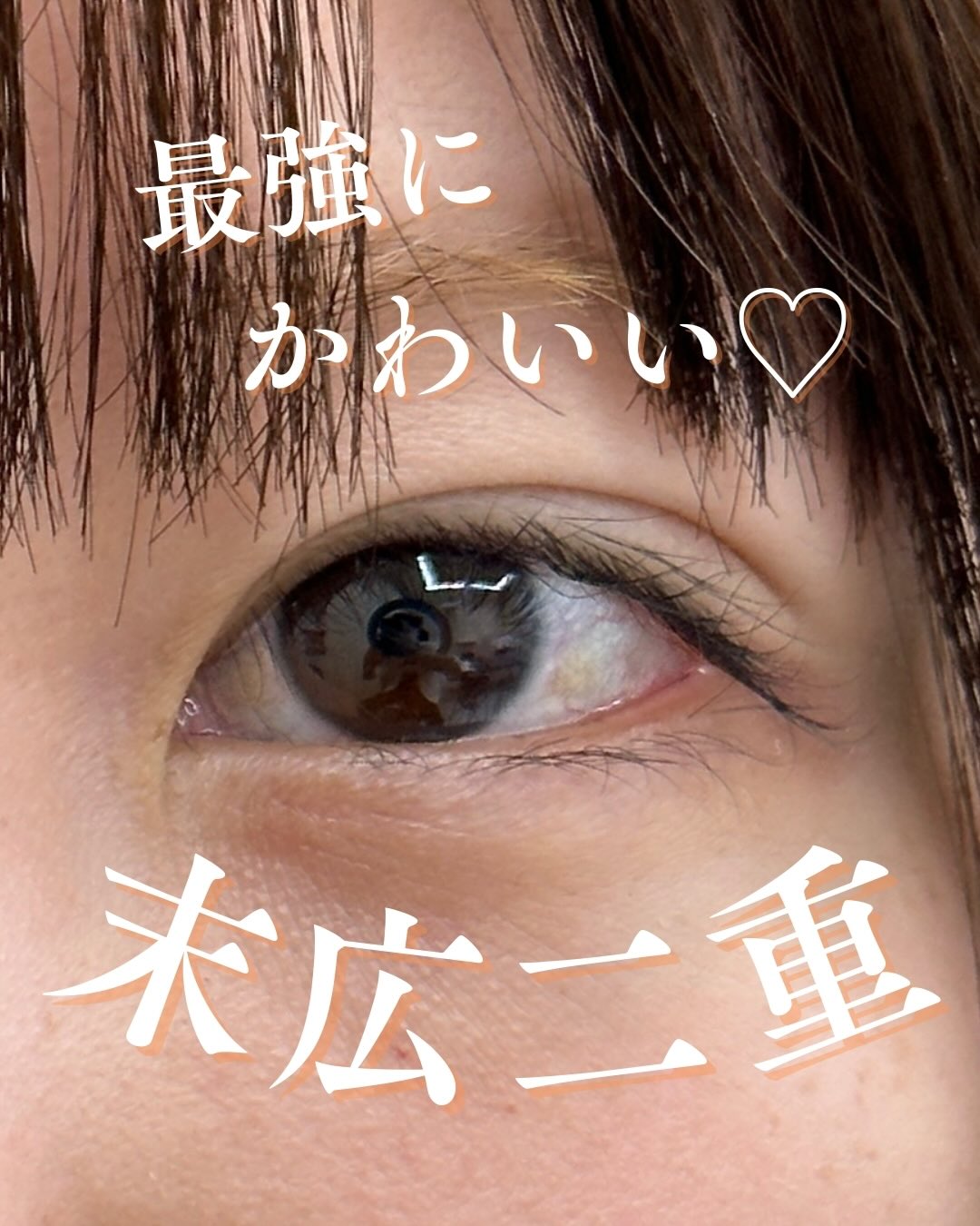 シークレットMトリプルで末広二重にのメイン画像