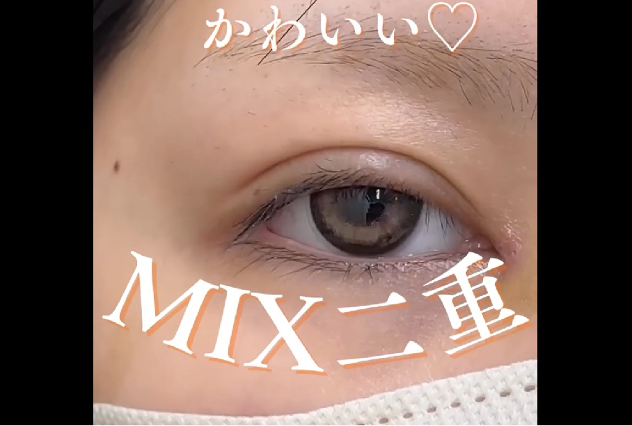 最強にかわいい！MIX二重のメイン画像