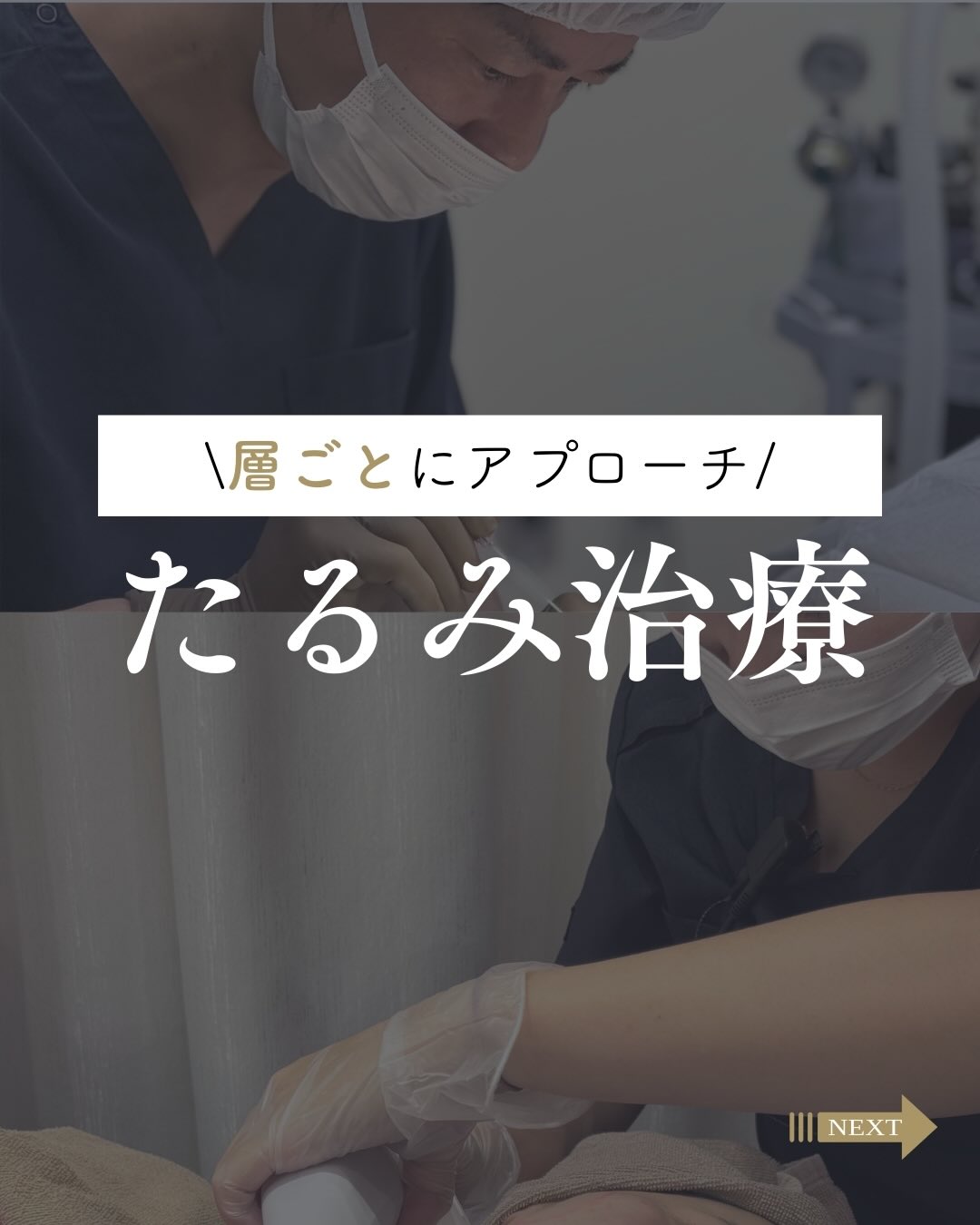 たるみ治療についてのメイン画像