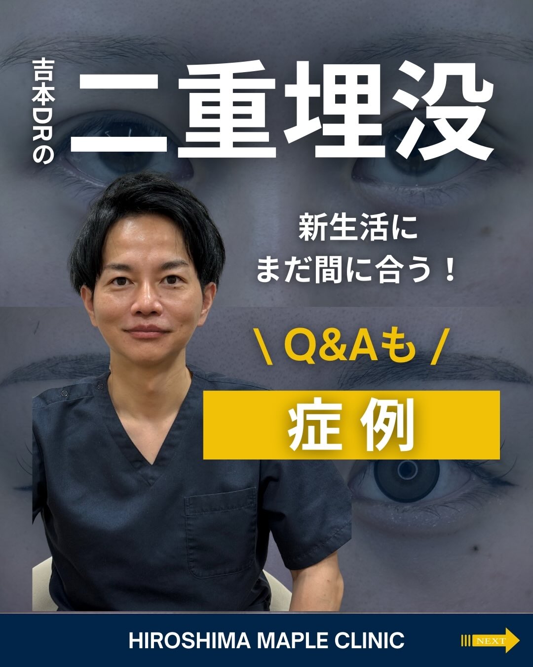 吉本医師の二重整形埋没法のメイン画像