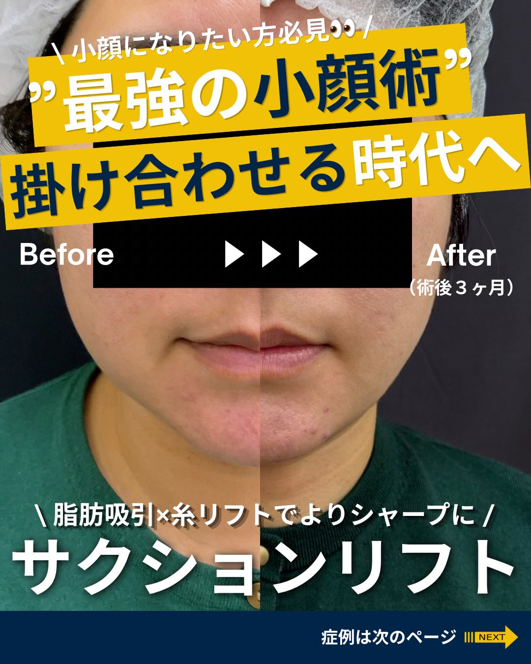 小顔になりたい人必見のメイン画像