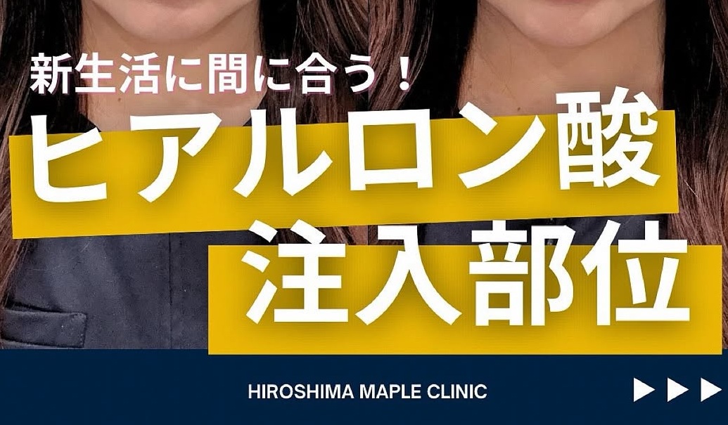 鼻根や涙袋へのヒアルロン酸注入のメイン画像
