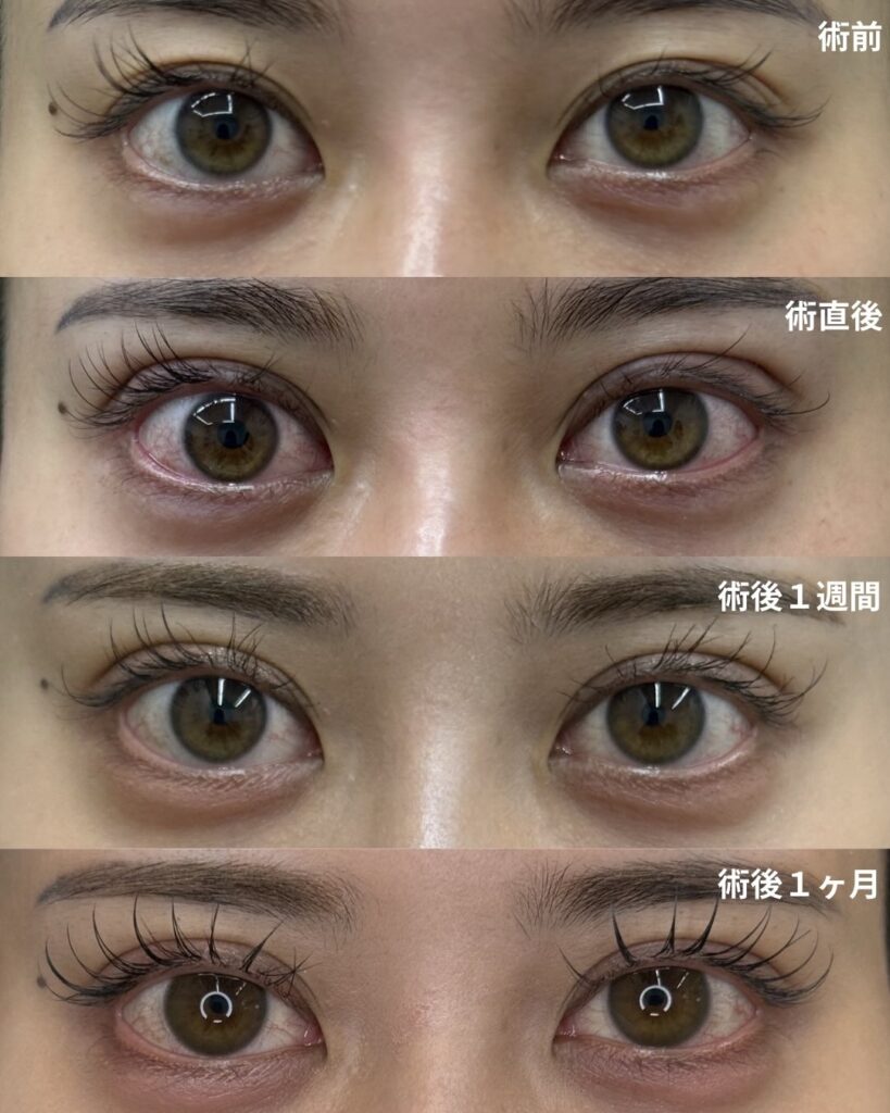 シークレットMダブル