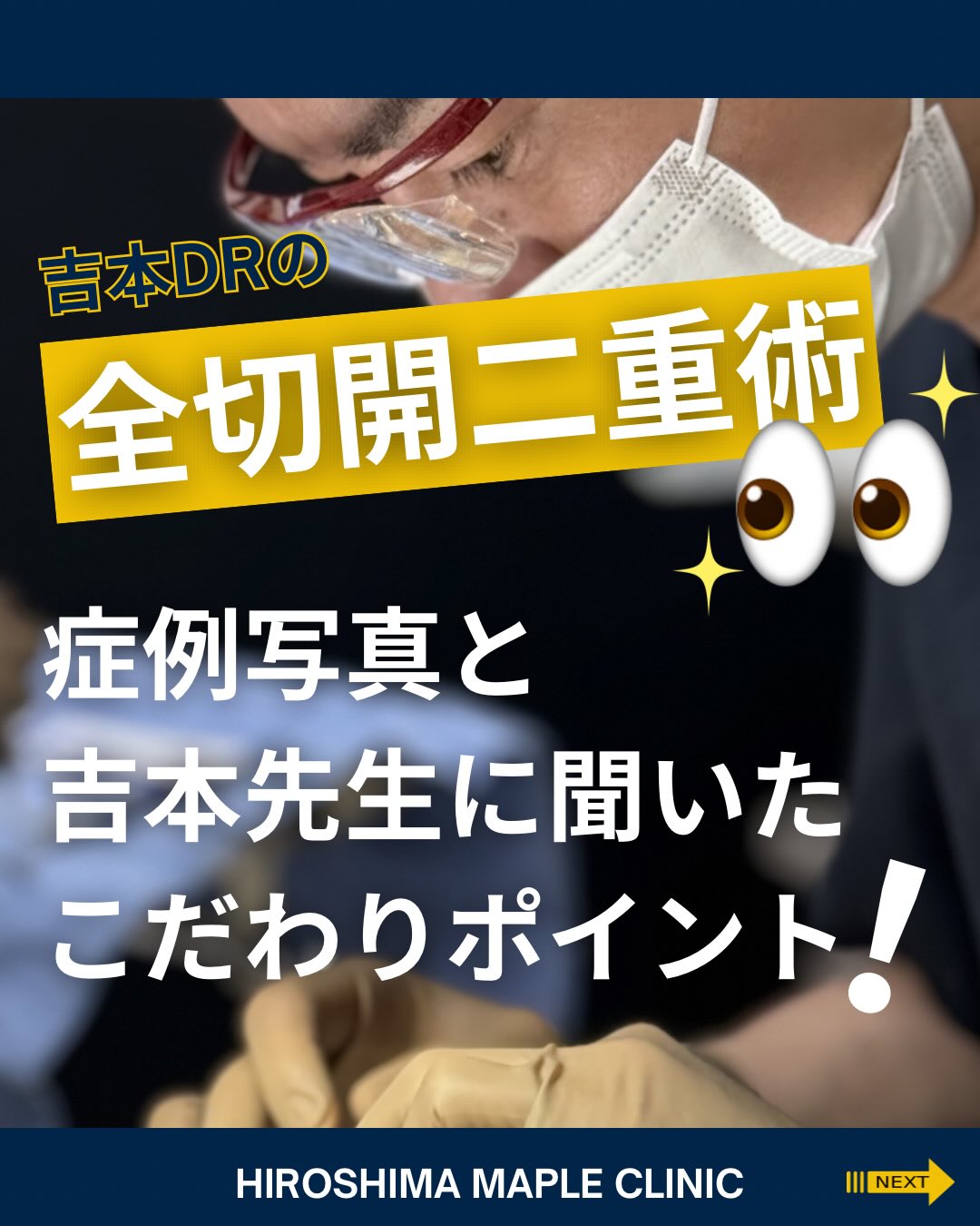 全切開二重術で大切にしていることのメイン画像