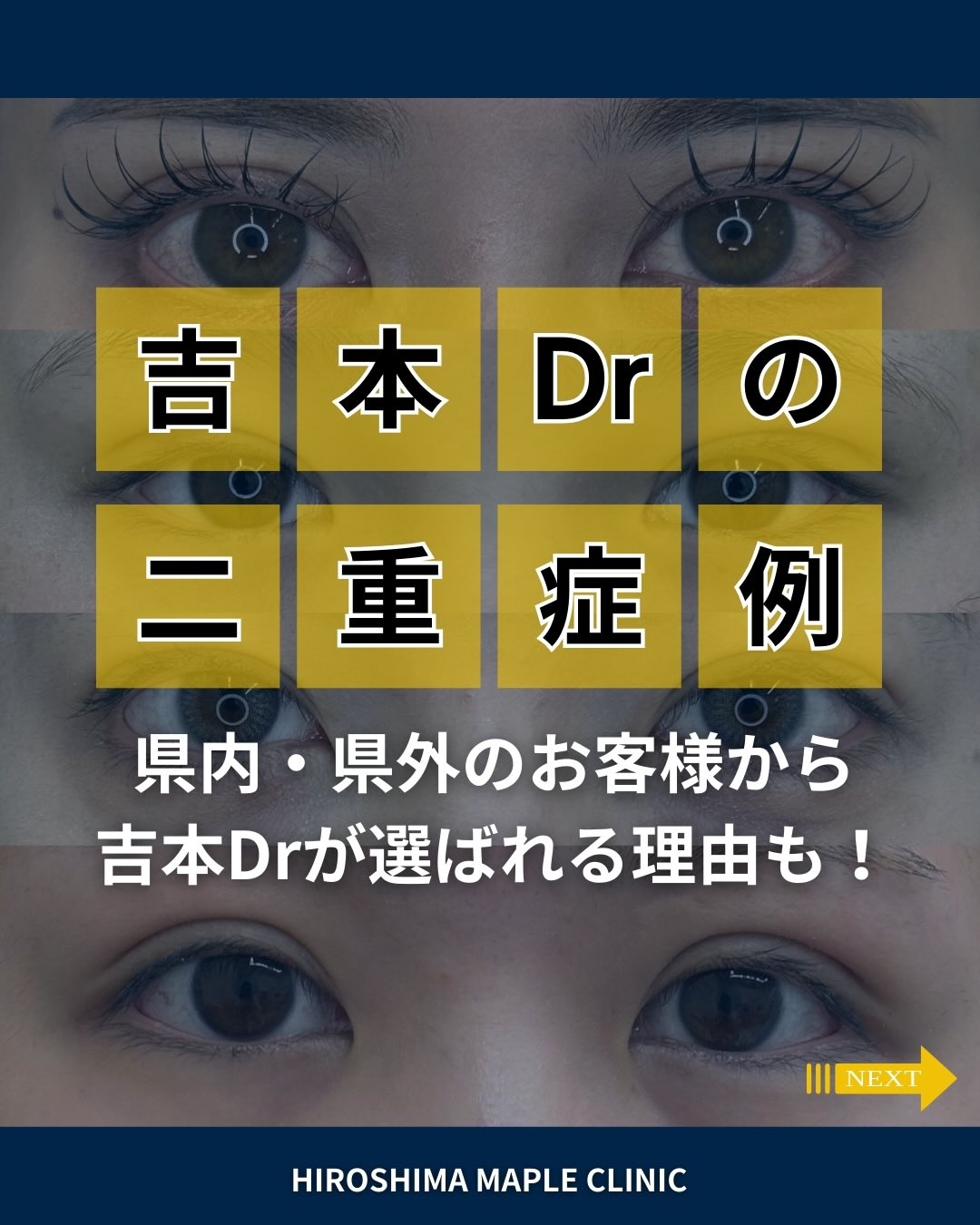 県外からもご来院いただく当院の二重整形埋没法のメイン画像