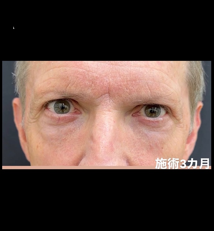 外国の方の施術も可能です！のメイン画像