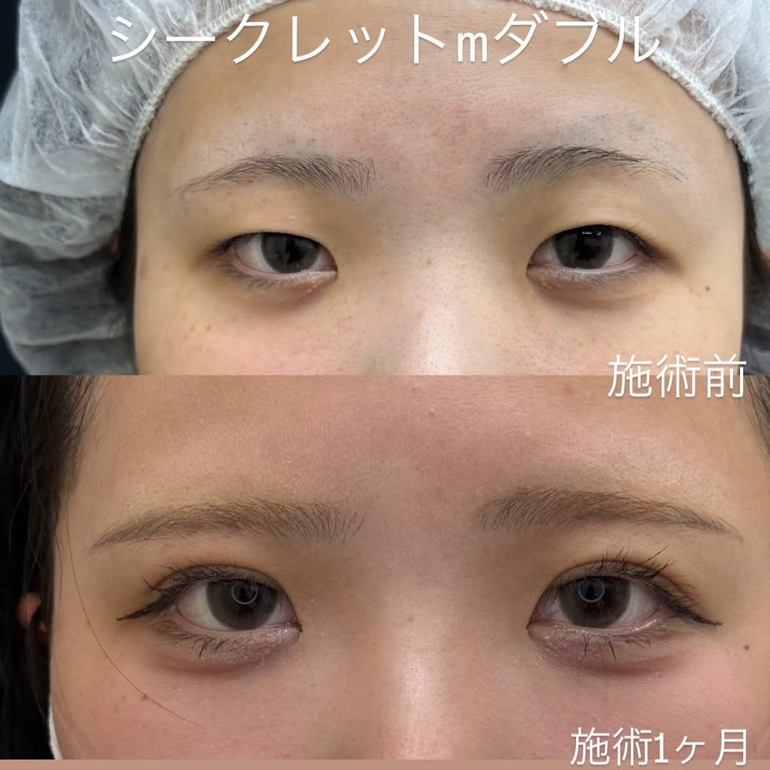 埋没法シークレットMダブルについてのメイン画像