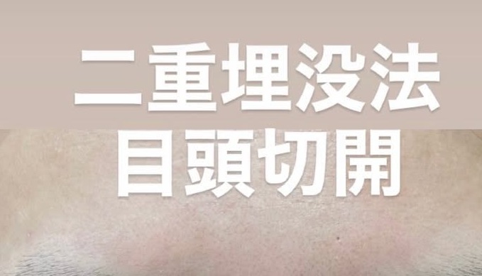 目元の複合治療、二重埋没法＋目頭切開のメイン画像