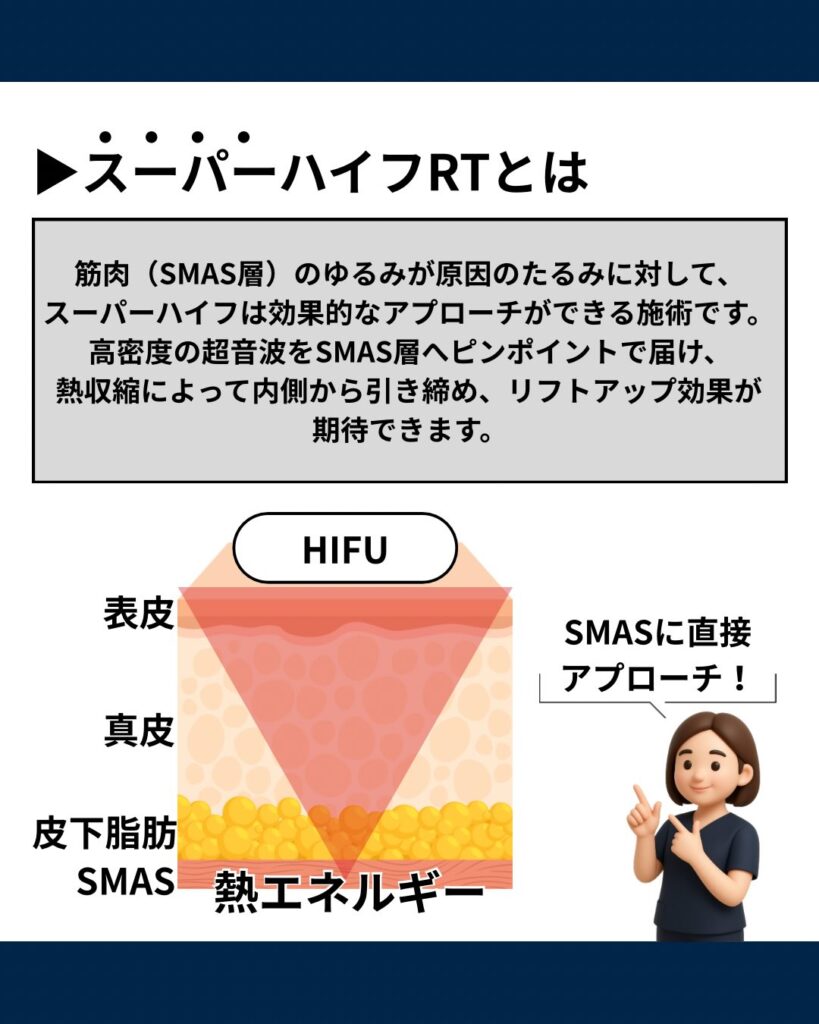 スーパハイフRTとは